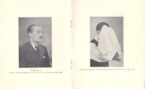 ++blog++baldness pics