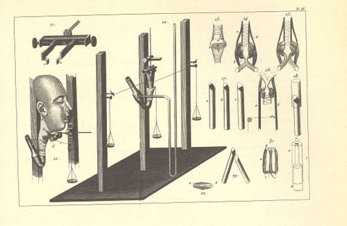 Blog 12 4 dada--throat