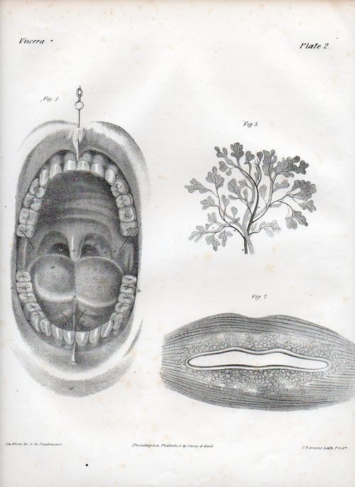 Dadaist senses mouth502 Dadaist senses mouth502