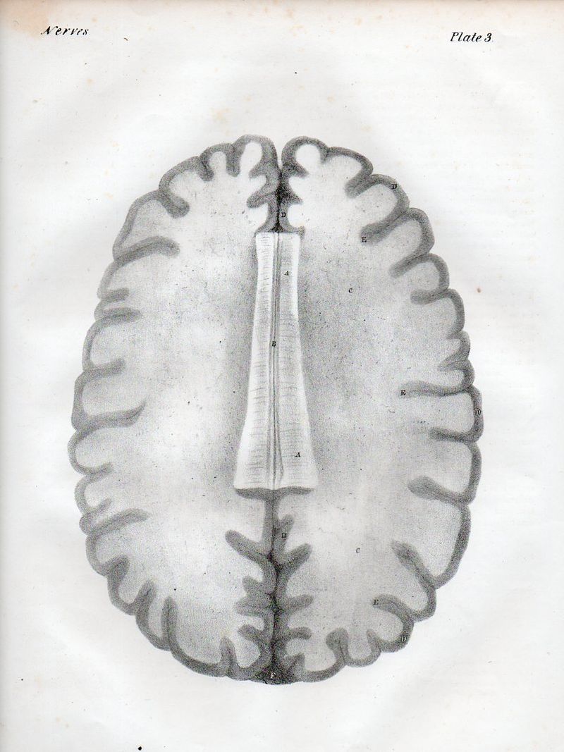 Brain522