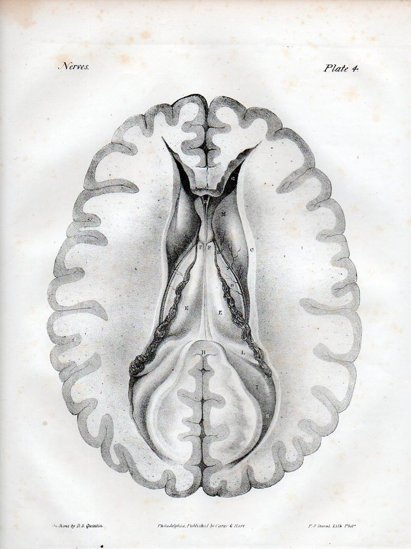 Brain523