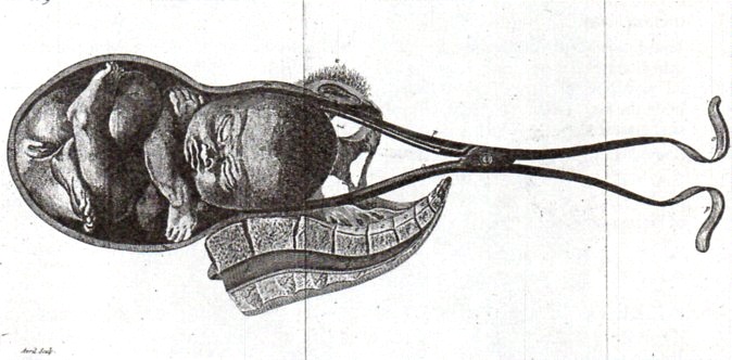 Anatomy bauldeqocue483