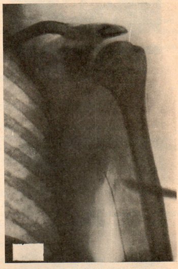 Forssmann654 Forssmann654