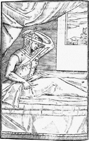 Medical manuscript nose