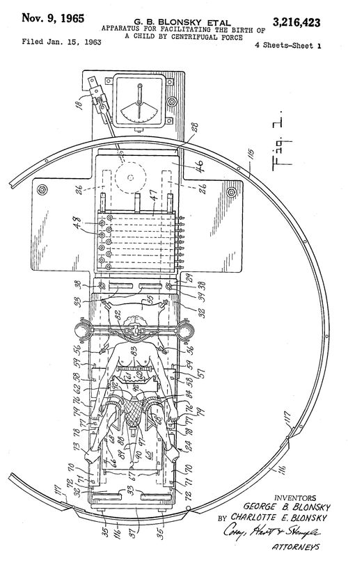 Centrifugal birth patent a overview fixed