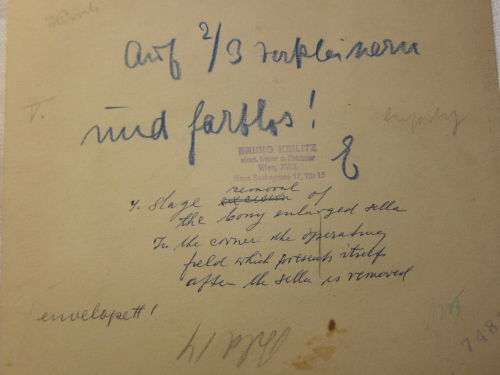 Pituitary _3_ back Pituitary _3_ back